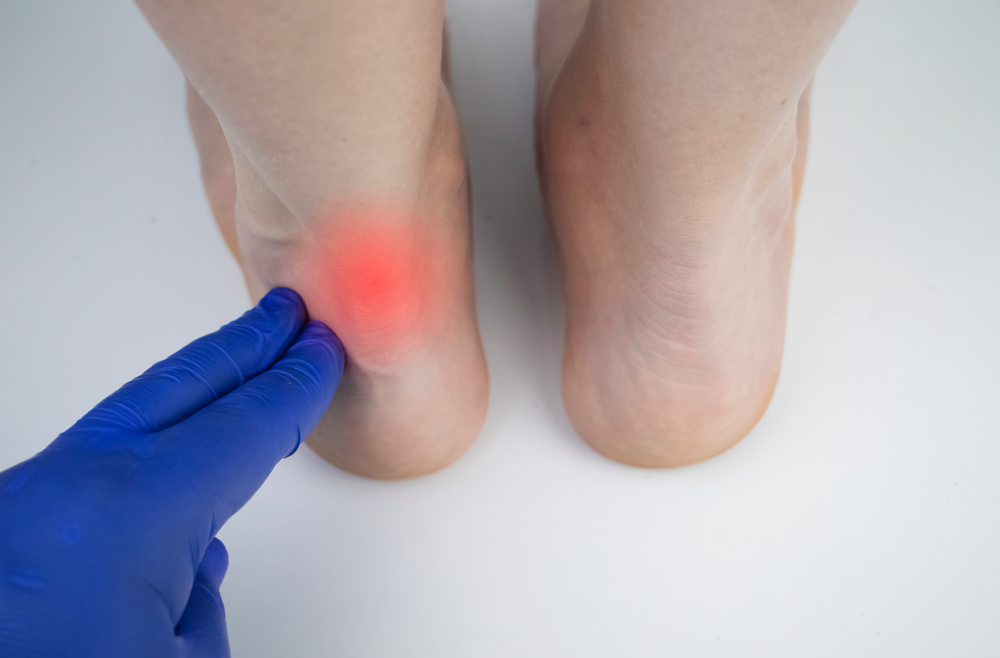 A close-up photo of an ankle. A physician applies pressure to the tendon